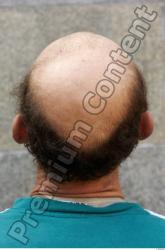 Hair Man White Slim Bald